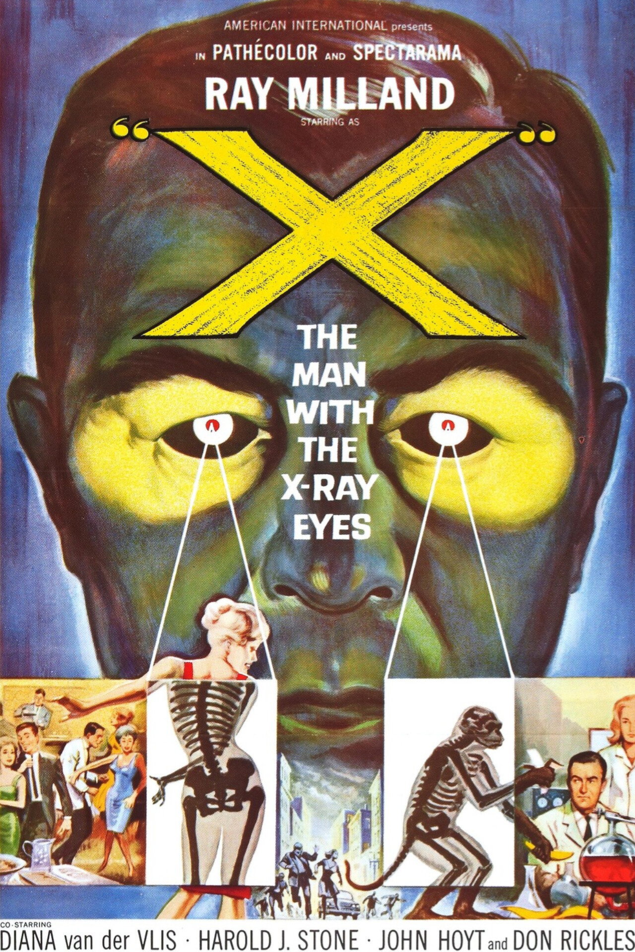 X